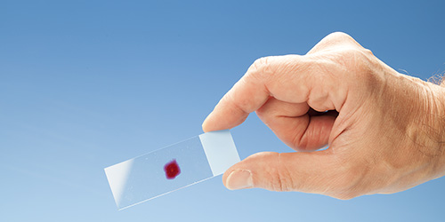 WRS Health Oncology EHR - Blood Oncology Tests for Templates and Charting