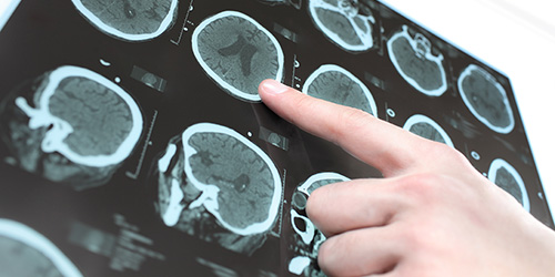 WRS Health Neurosurgery EHR Templates and Charting